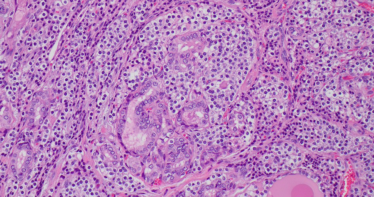 Signout Machine ⚙️ tweet media