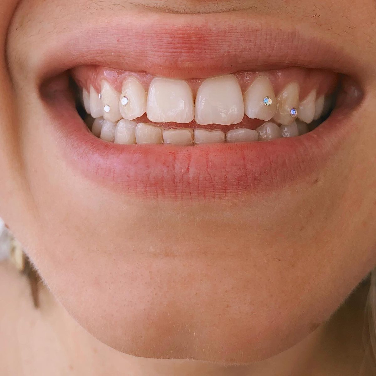junnelyvieraa's tweet photo. Tengo espacio para Tooth Gems la semana que viene 💖 Envíame un DM https://t.co/1sPhHqOyO4