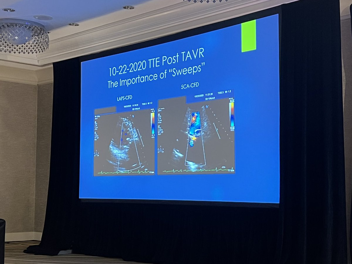 AkhilNarangMD's tweet photo. Dr David Mehlman needs no introduction (except to Twitter). He’s a stalwart of the #EchoFirst lab @NorthwesternMed @NMCardioVasc and has been present at every #EchoNU conference for the past 43 years! Amazing educator for generations of trainees! https://t.co/1MtGQvlncS