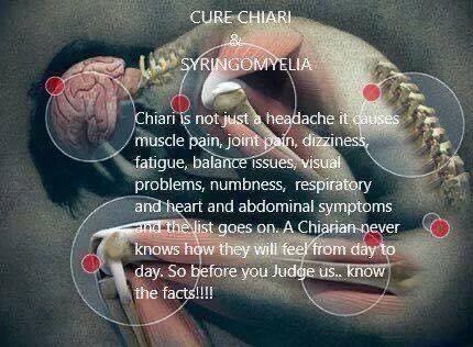 nicolesylvie's tweet photo. Day 10 of Chiari Malformation Awareness month #ChiariMalformationAwareness #chiarimalformation #chiarilife

#chiaristrong #chiariwarrior #chiariwillnotwin #chiarisurvivor #chiarisurgery https://t.co/1yqlblxdVz