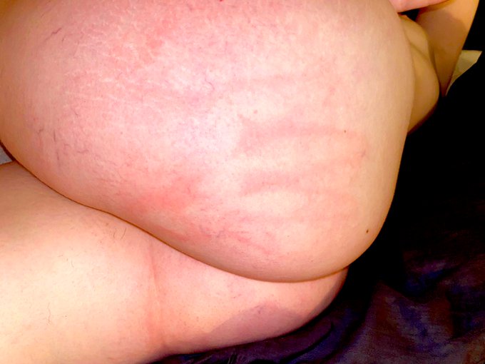 I was a bad girl last night 🥵🤭🫣 #spanking #nsfwtwt #bdsm #RETWEEET #badgirl #kinkytwitter #handprint<a href="/tag/spanking"class="tags">#spanking</a><a href="/tag/nsfwtwt"class="tags">#nsfwtwt</a><a href="/tag/bdsm"class="tags"><span>#bdsm</span></a><a href="/tag/badgirl"class="tags"><span>#badgirl</span></a><a href="/tag/retweeet"class="tags"><span>#retweeet</span></a><a href="/tag/handprint"class="tags"><span>#handprint</span></a><a href="/tag/kinkytwi"class="tags"><span>#kinkytwi</span></a>