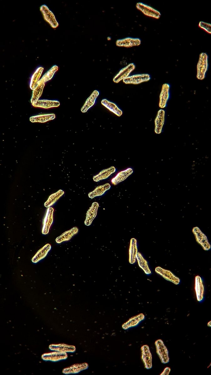 cyanochic's tweet photo. I'm not going to shut up about this photo for a very long time. #diatoms #limnology #microscopy #SciArt https://t.co/GM88vYxDE6