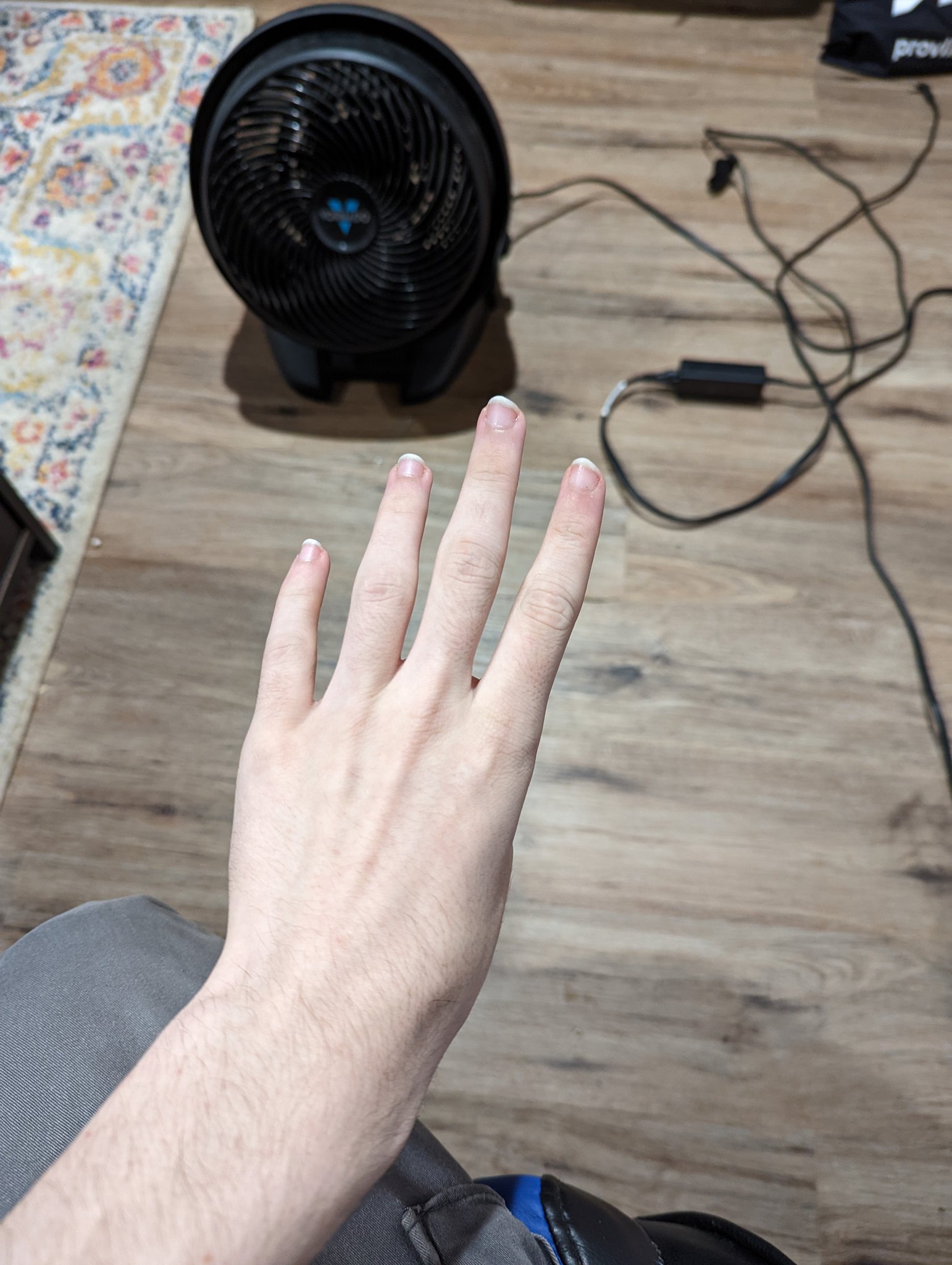 Tycho → Furpoc → ANE on Twitter: "Guys I cut my thumb off :( https://t