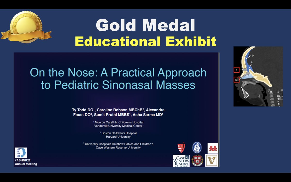 Congratulations to Drs. Todd, @callyrobs, @alexandra_foust, Pruthi, & @ashasarm for the #ASHNR22 Gold Medal Educational Exhibit!