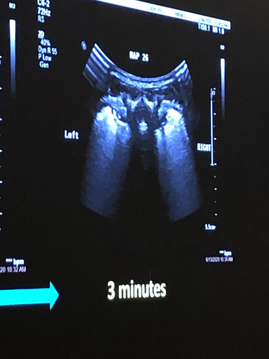 DrSamRay's tweet photo. Spot the eagle! Great POCUS talk @ChorYek #ASMIC2022 https://t.co/NA7fDRlThE