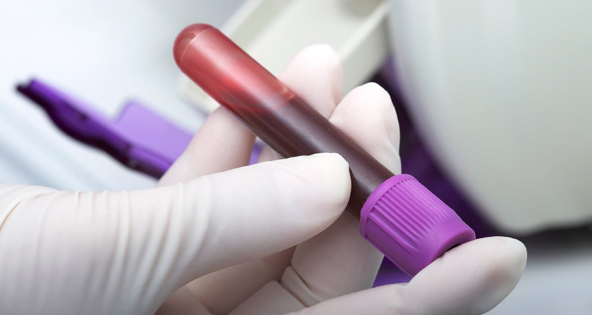 WebMD's tweet photo. New research suggests patients suspected of ALS may soon be able to get a diagnosis much more quickly, not wasting their precious time. https://t.co/3iw4xMEcCa https://t.co/D2pdZdzVop