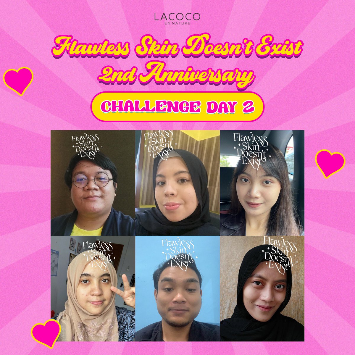 𝘾𝙃𝘼𝙇𝙇𝙀𝙉𝙂𝙀 𝘿𝘼𝙔-2

✨ Drop selfie-mu pakai filter FSDE LACOCO yang ada di Instagram Lacoco (instagram.com/lacoco.id?igsh…) + kasih tau kenapa kamu bangga sama dirimu!
✨ Jangan lupa pencet 🔁+❤️ yaa

Go go go goo🥳 #FlawlessSkinDoesntExist