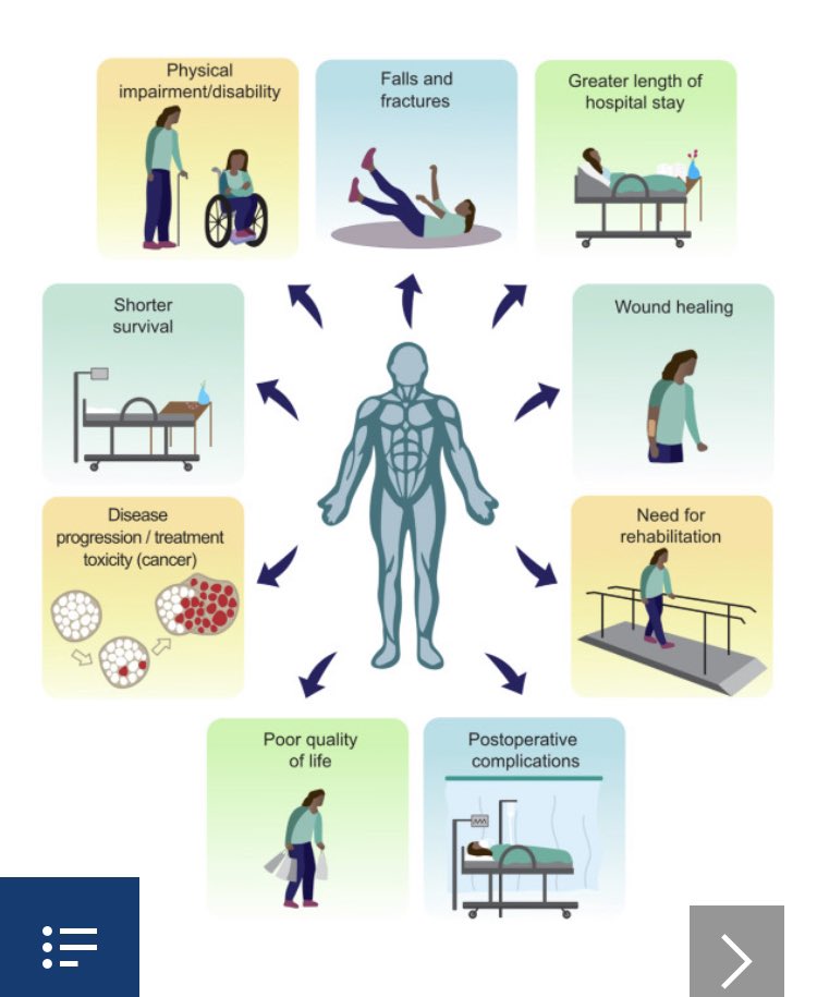 Recién salido del horno: excelente revisión con una iconografía 🔝🔝 sobre el músculo de nutrición de <a href="/DrCarlaPrado/">Carla Prado, PhD, RD, FCAHS</a> clinicalnutritionjournal.com/article/S0261-…