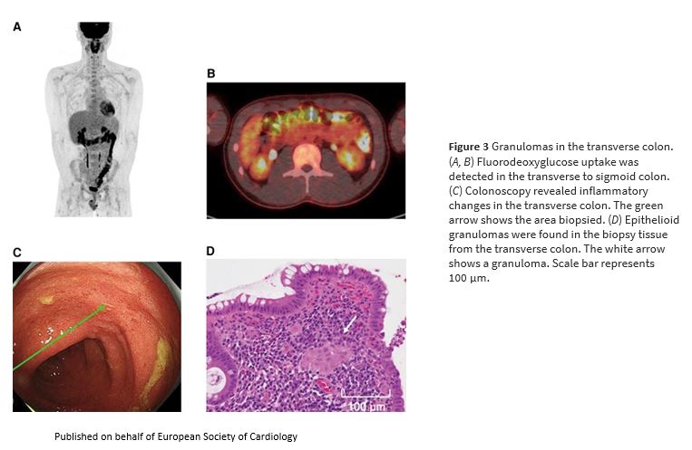 European Society of Cardiology Journals tweet media
