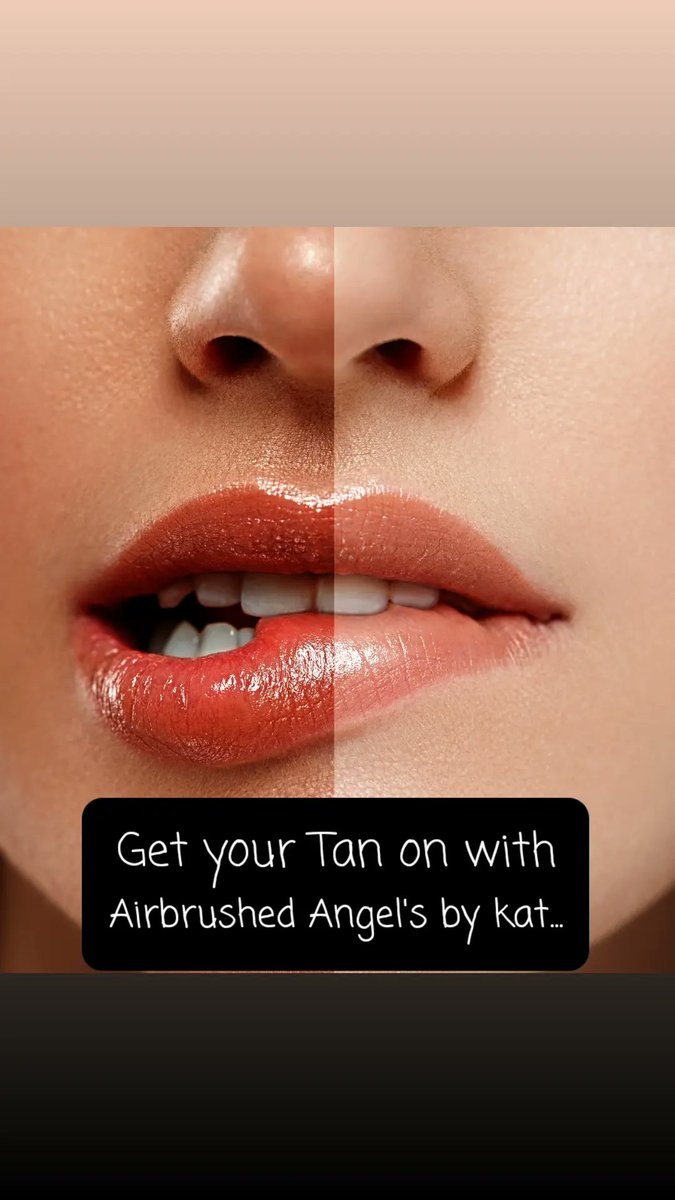 AABK2017's tweet image. Sienna x spray tans available with Kat every day this week untill 9pm.With a choice of shade.We also offer a unique clear spray Bridal tan.
#Siennaxspraytanworcester
#bridaltan
#weddingtan
#clearspraytan