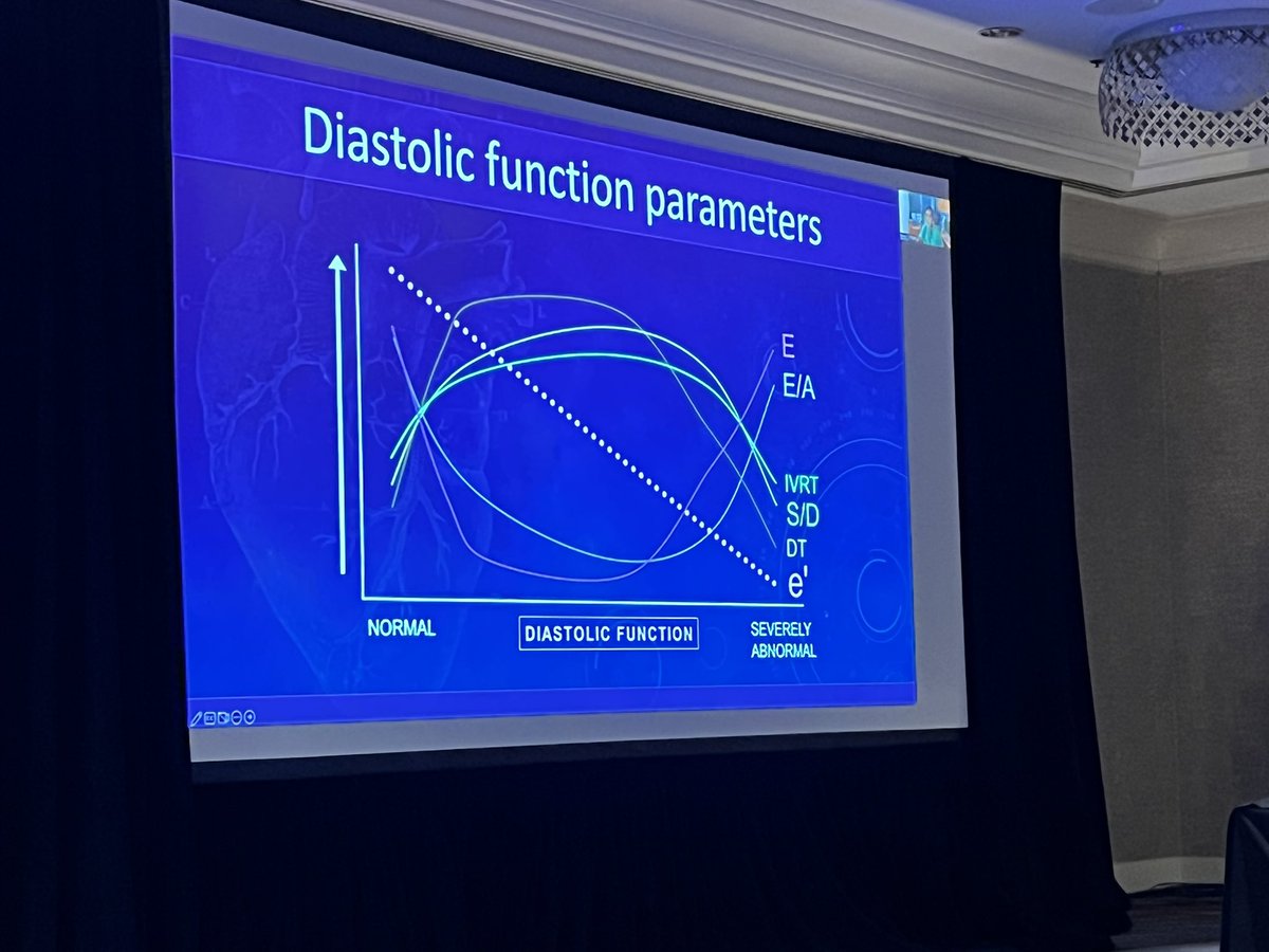 AkhilNarangMD's tweet photo. Expert analysis of diastology by @HFpEF himself at #EchoNU. Not all diastology is indeterminate. Dig deeper with #EchoFirst and integrate as much information as possible. https://t.co/mCBOSUHZMn