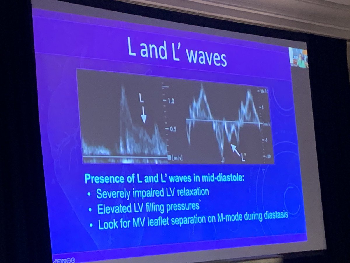 RigolinVera's tweet photo. Look for an L and L’ waves in mitral inflow and tissue Doppler as a clue to elevated LV filling pressures. @HFpEF #EchoNu @NMCardioVasc https://t.co/cDdKctSvOS