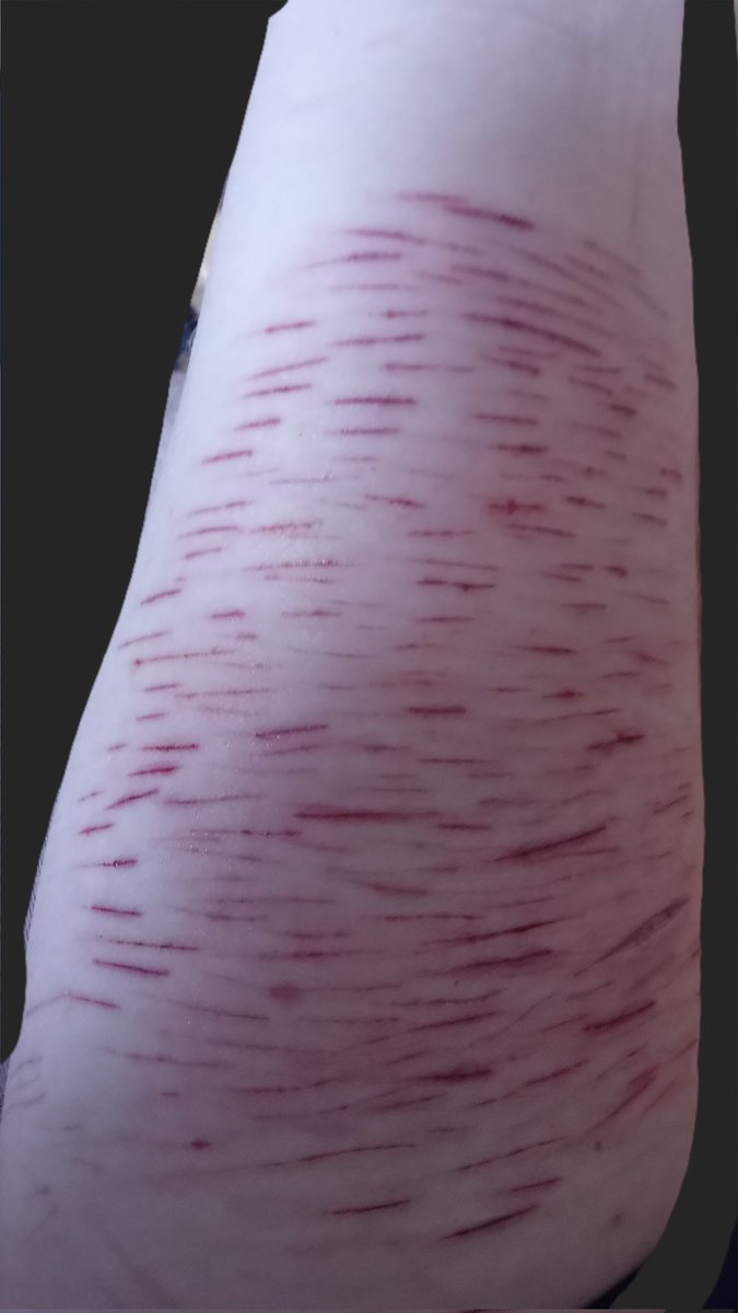 frks6969's tweet photo. TWITTER IT'S FAKE!! no one was harmed^^

Shtwt suicidetwt bladetwt bloodietwt stryotwt beantwt https://t.co/VL2dD1IaVv