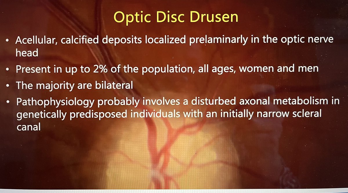 #WOC2022 #ODD found in one study to be present in 51% of those with #NAION The #odd-consortium has world wide Neuro-op buy in. Congratulations on all the work <a href="/HamannSteffen/">Dr. Steffen Hamann</a> <a href="/clarefraser/">Dr Clare Fraser</a> <a href="/NANOSTweets/">NANOS</a> <a href="/EunoSsociety/">EUNOSsociety</a> <a href="/FionaCostello5/">Fiona Costello</a> <a href="/DanMilea3/">Dan Milea</a> watch for the next study #NARROW