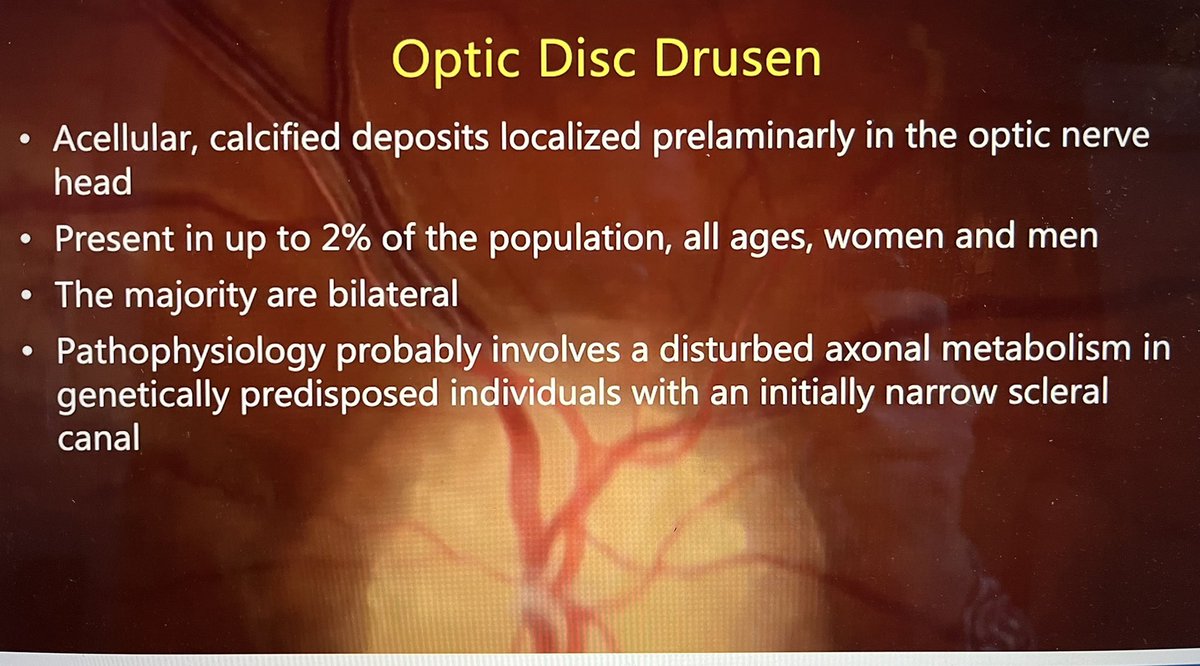 #WOC2022 #ODD found in one study to be present in 51% of those with #NAION The #odd-consortium has world wide Neuro-op buy in. Congratulations on all the work @HamannSteffen @clarefraser @NANOSTweets @EunoSsociety @FionaCostello5 @DanMilea3 watch for the next study #NARROW