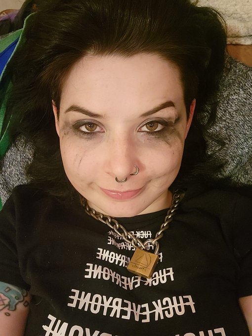 Can anyone guess what happened to my face? Comment your answer and if someone makes me laugh I'll drop<a href="/tag/mvsales"class="tags"><span>#mvsales</span></a><a href="/tag/mvtrans"class="tags"><span>#mvtrans</span></a>