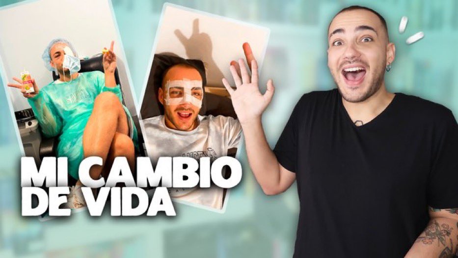 JosuDiamond's tweet photo. NUEVO VÍDEO 🔥

Todo sobre mi CIRUGÍA OCULAR con LENTES ICL ✨

➡️ https://t.co/cyIf7COVS1 https://t.co/y5byaqP19O