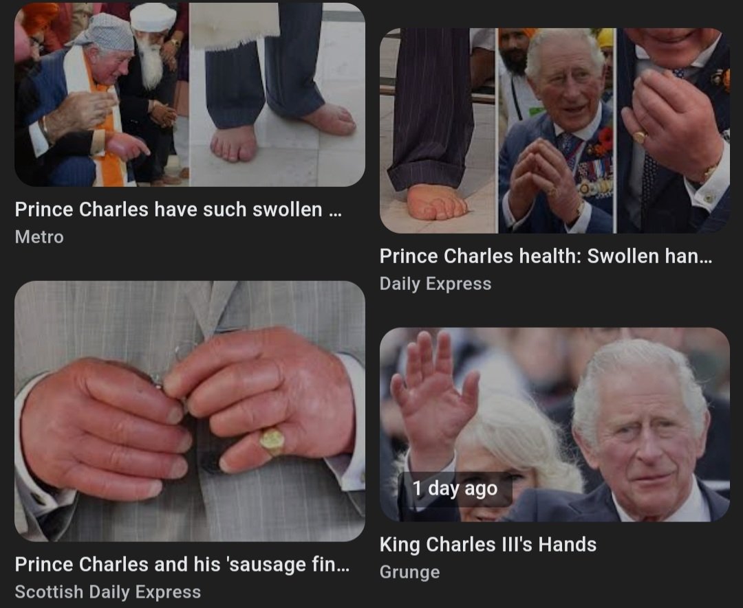 schmerdybird's tweet photo. Looks better than Charles' actual hand lmaoooo https://t.co/GPNXV5zpo6