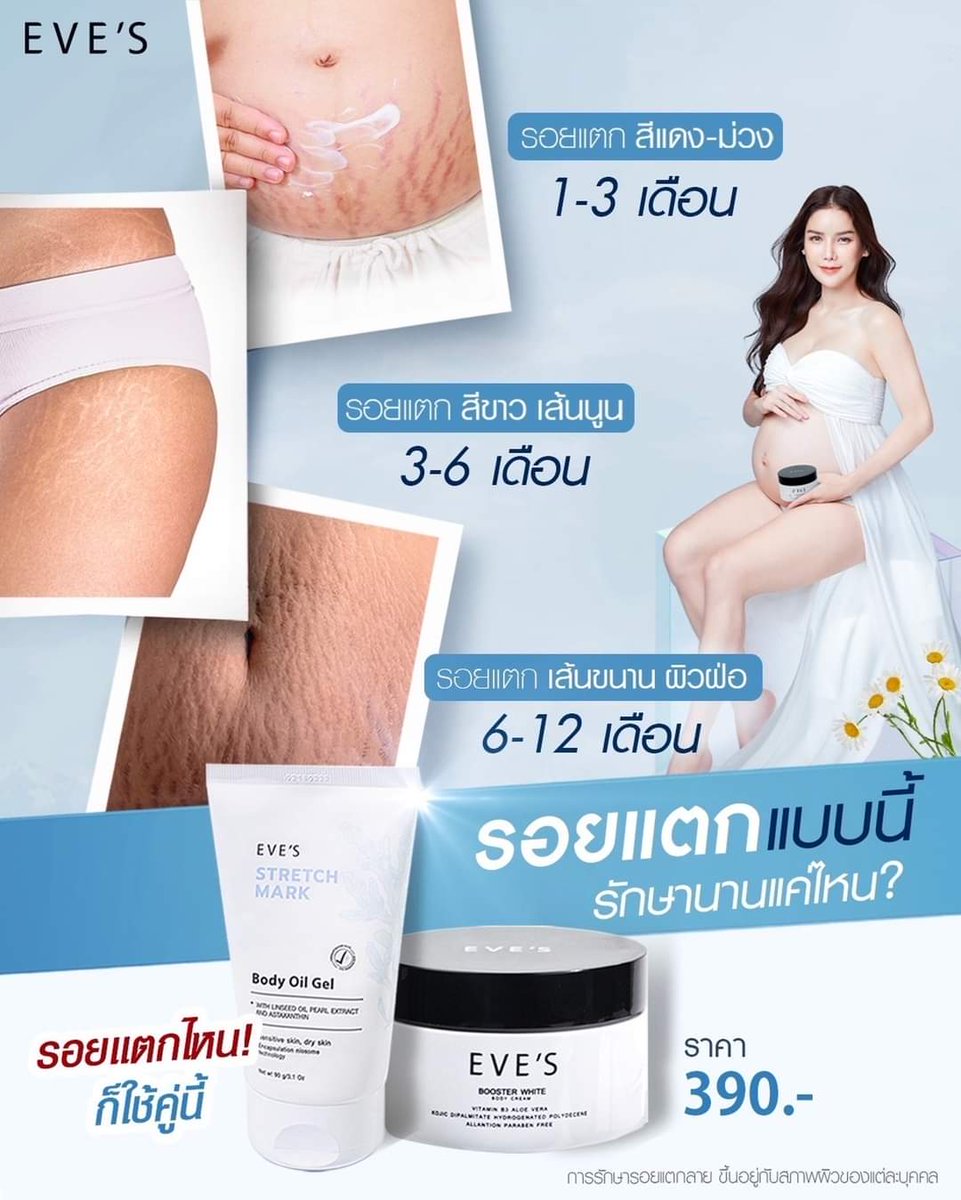 evesbynewtyme's tweet photo. จบปัญหากวนใจเรื่องรอยแตกลายไปได้เลยค่าา 😉✨

#EVES #EVESOIL #อีฟส์ออยล์ #บูสเตอร์อีฟส์ 
#evesรังสิต https://t.co/bOYAhbCtL5