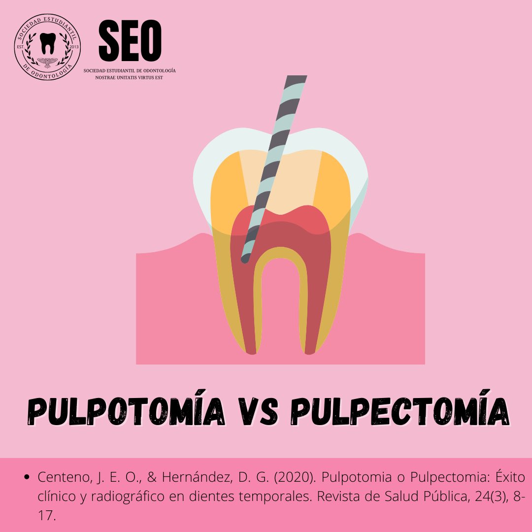 SEO_Unison's tweet photo. 🐙PULPOTOMÍA VS PULPECTOMÍA🐙

#OdontoBúhos https://t.co/j3YSERQbNz
