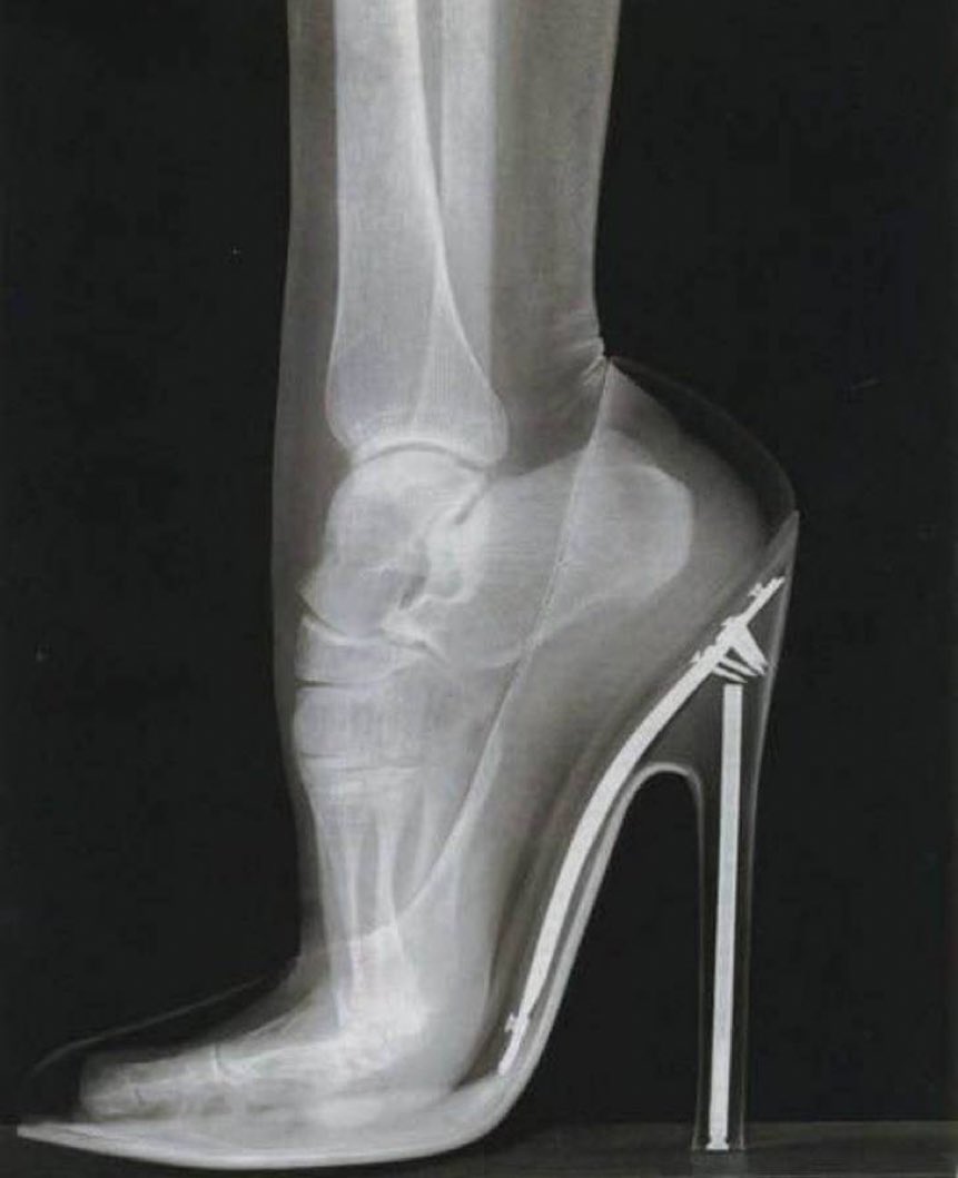victor_gordoa's tweet photo. Caray, se ven bien, pero por salud física deberían abolirse. Ustedes amigas ¿qué opinan? ¿Al diablo con los tacones? https://t.co/puJZ0WOwHu