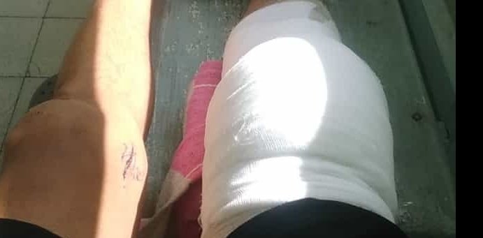 canalmarangatu's tweet photo. Fabián es un vecino de la zona que a raíz de un accidente de tránsito sufrió una fractura ósea,  lo operaron el viernes y ahora durante 3 meses necesitará una silla de ruedas en préstamo. Si alguien puede ayudar el WhatsApp es 096 774 818 https://t.co/33LBwCiHoS