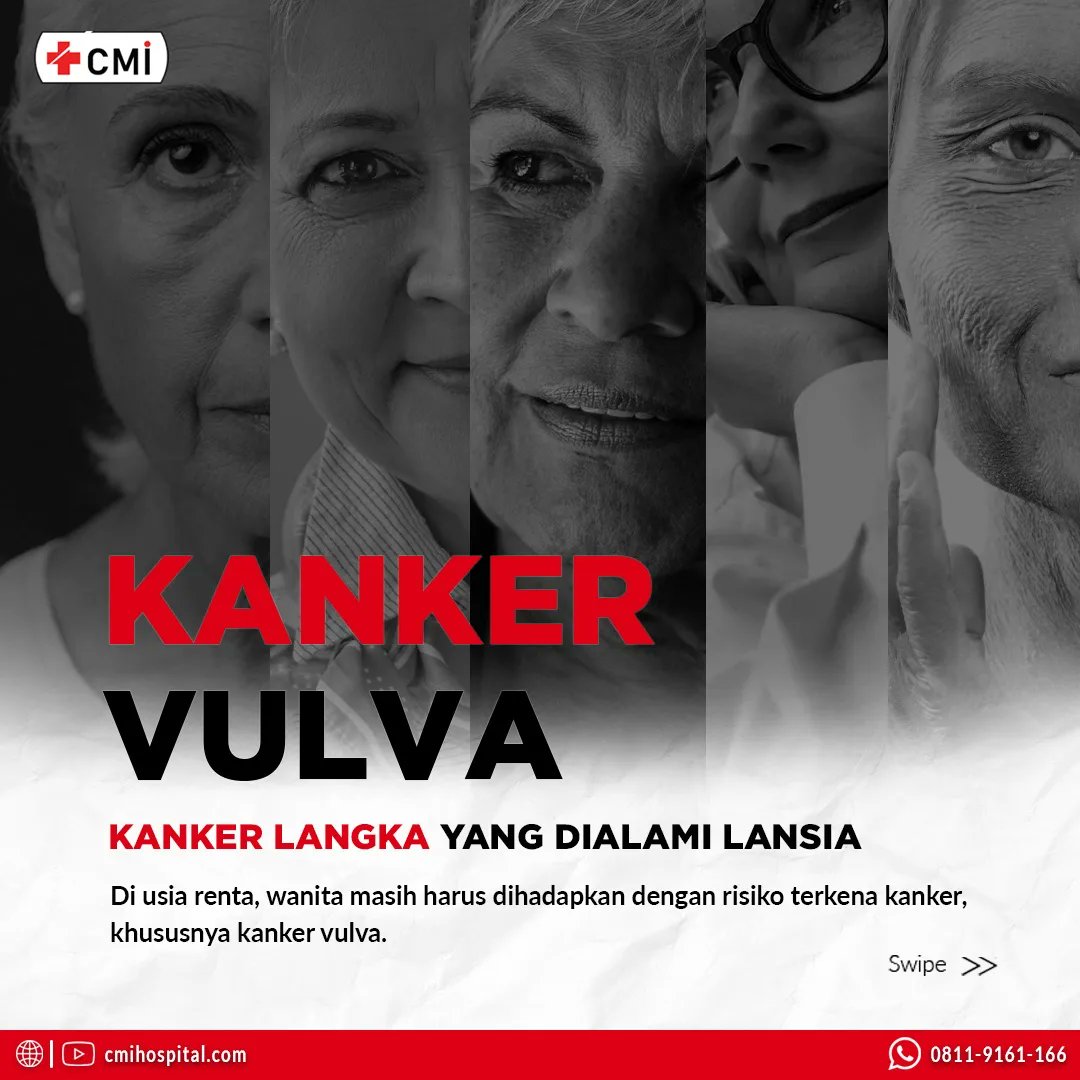 cmihospitals's tweet photo. Kanker vulva menjadi salah satu masalah kesehatan yang diderita wanita, tidak hanya bagi wanita yang sudah memasuki masa menopause atau lansia, tetapi juga bagi wanita usia muda
#gejalakanker #cirikanker #solusikanker #pengobatankanker #obatkanker #terapikanker #cmihospital https://t.co/f9UFoLaIu0