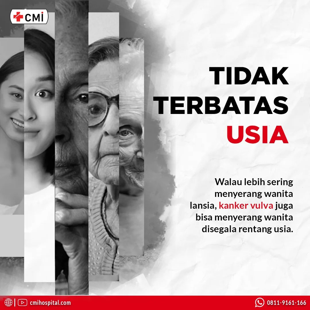 cmihospitals's tweet photo. Kanker vulva menjadi salah satu masalah kesehatan yang diderita wanita, tidak hanya bagi wanita yang sudah memasuki masa menopause atau lansia, tetapi juga bagi wanita usia muda
#gejalakanker #cirikanker #solusikanker #pengobatankanker #obatkanker #terapikanker #cmihospital https://t.co/f9UFoLaIu0
