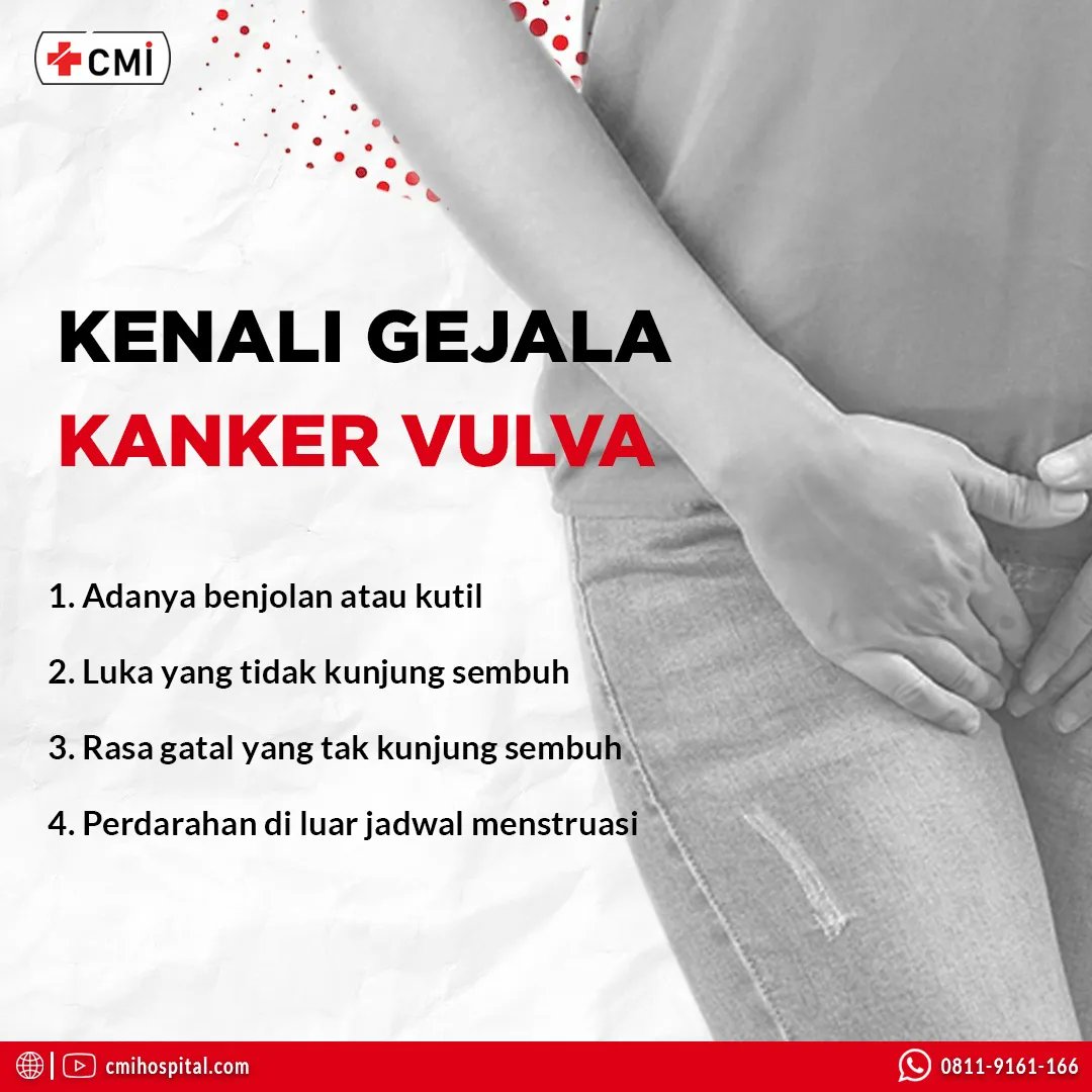 cmihospitals's tweet photo. Kanker vulva menjadi salah satu masalah kesehatan yang diderita wanita, tidak hanya bagi wanita yang sudah memasuki masa menopause atau lansia, tetapi juga bagi wanita usia muda
#gejalakanker #cirikanker #solusikanker #pengobatankanker #obatkanker #terapikanker #cmihospital https://t.co/f9UFoLaIu0