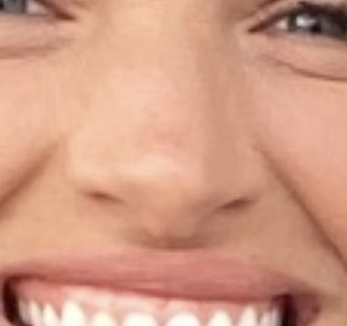 NobrainXelon's tweet photo. @deanbyrne2018 @UFCBroPicks That nose tho😂😂😅😅⚰️⚰️⚰️😅 https://t.co/KzeczYjutW