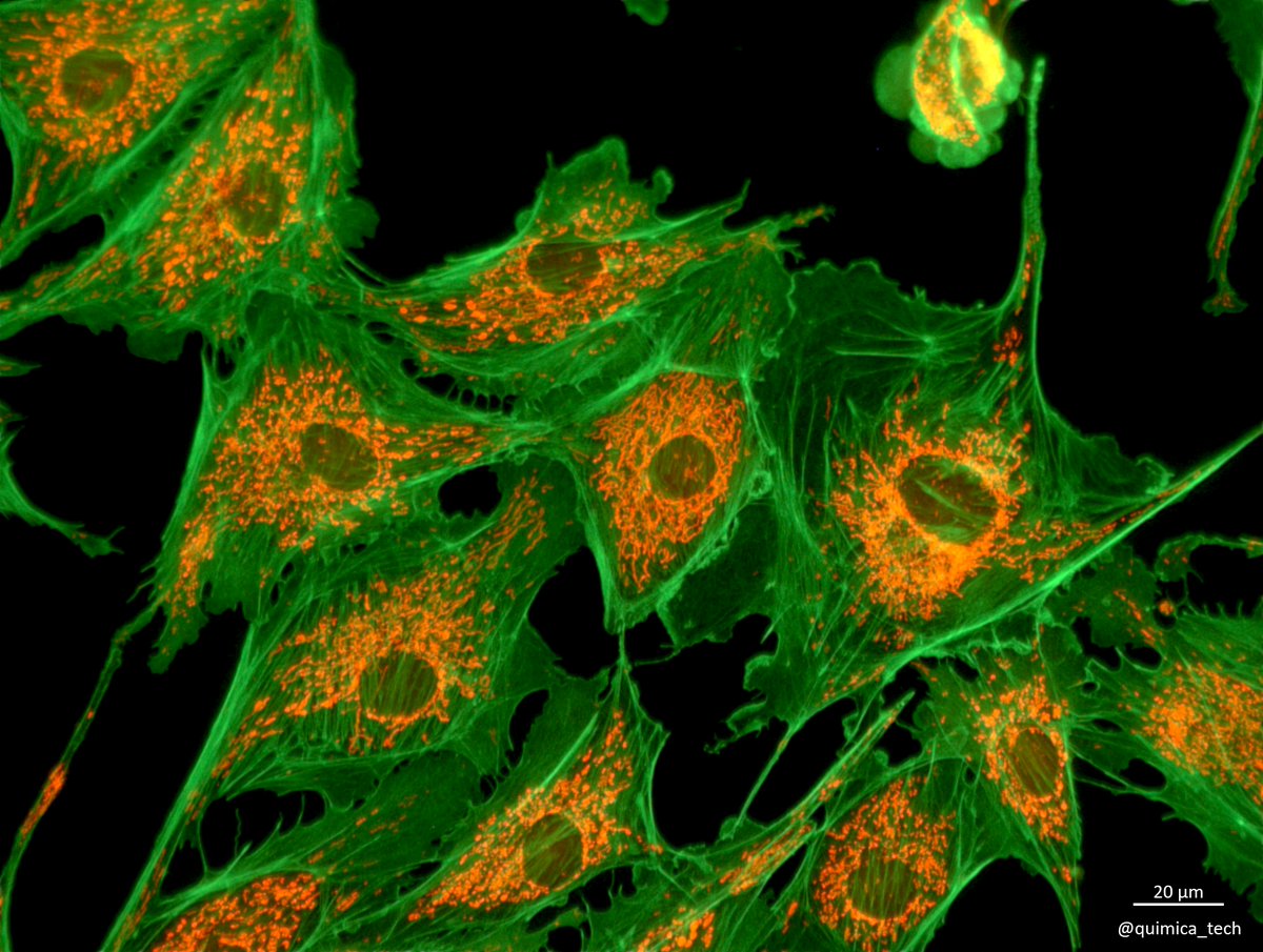 Optolongfilter's tweet photo. #MicroscopyMonday
BPAE cells !
Image credit @Química Tech SA de CV
Filter sets : FITC , TRITC
#Microscopy #opticals #Opticalthinfilmcoatingfilters #Fluorescence #Fluorescencemicroscope https://t.co/kTIRjadUF5