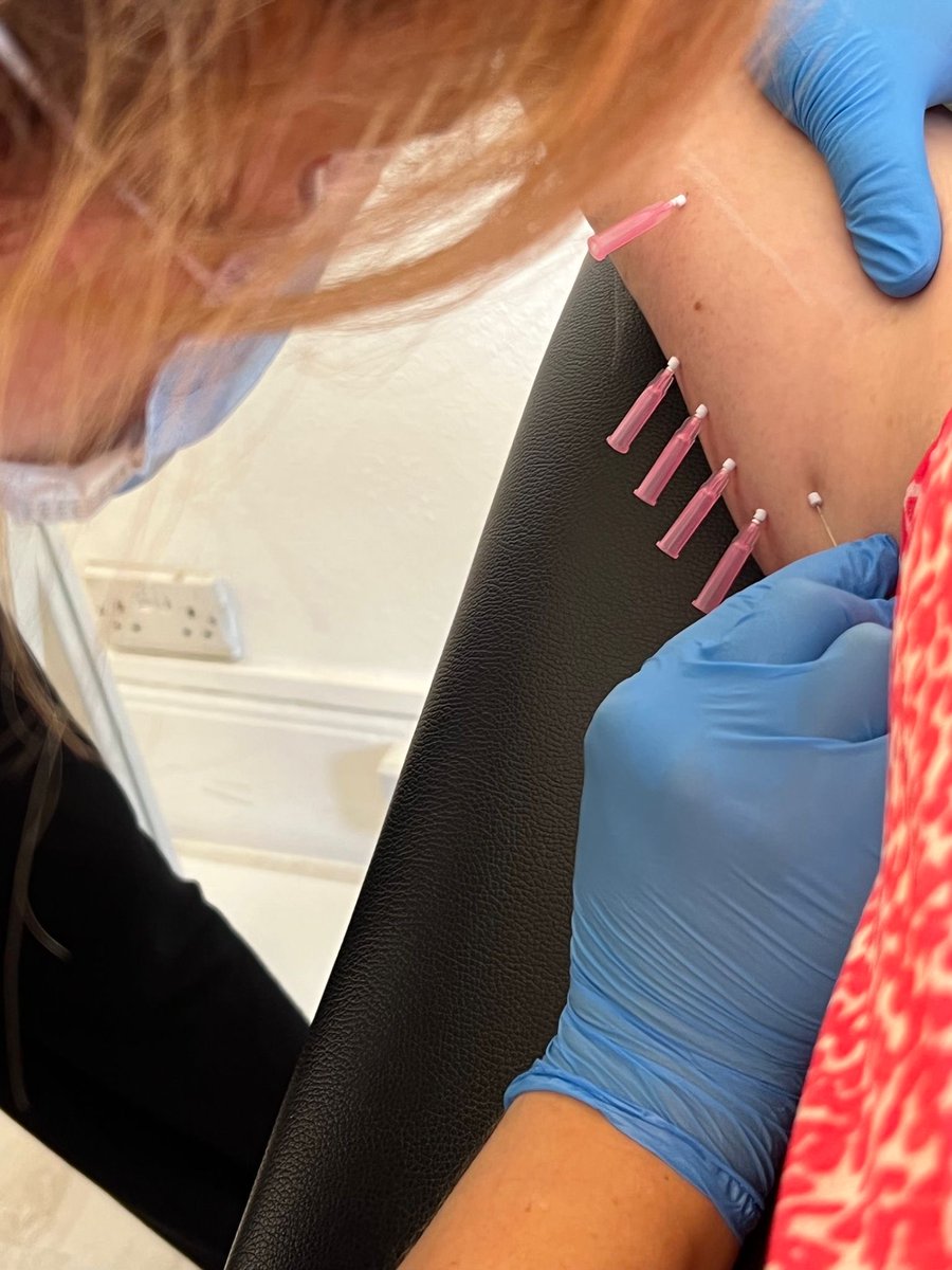 Aesthe1Complete's tweet photo. #Mono #PDO #threads for tightening skin underarms get the #collagen back to skin. Will see result in 2 months time https://t.co/PDa32xDWo1