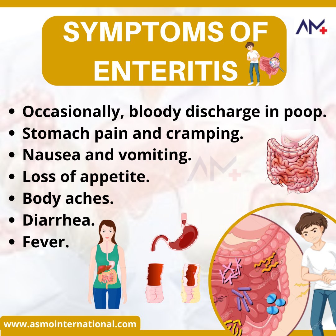 ashimamunjal05's tweet image. Symptoms of Enteritis.
.
bit.ly/3nHERKo
.
#symptomsofenteritis #enteritis #enteritissurvivor #enteritissymptoms #symptoms #occasionally #bloodydischarge #stomach #stomachpain #cramping #nausea #vomiting #lossofappetite #bodyaches #diarrhea #fever #dehydration #healthcare