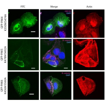 Biochem_Journal's tweet photo. New #OpenAccess research: Differential regulation of the pairs of 14-3-3-binding phosphosites on PAK4, PAK5 and PAK6, which comprise a family of ohnologues. https://t.co/Me9rdhAmWS https://t.co/YXlIseC7bF