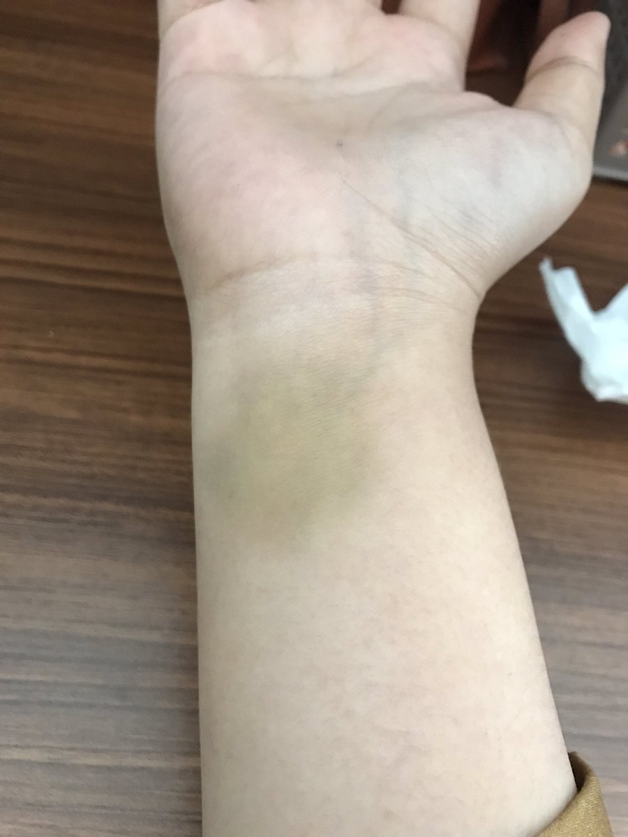 epotaatoo's tweet photo. Day 4 yg 3 nya lupa pap hehe https://t.co/KtbFKr4FY8