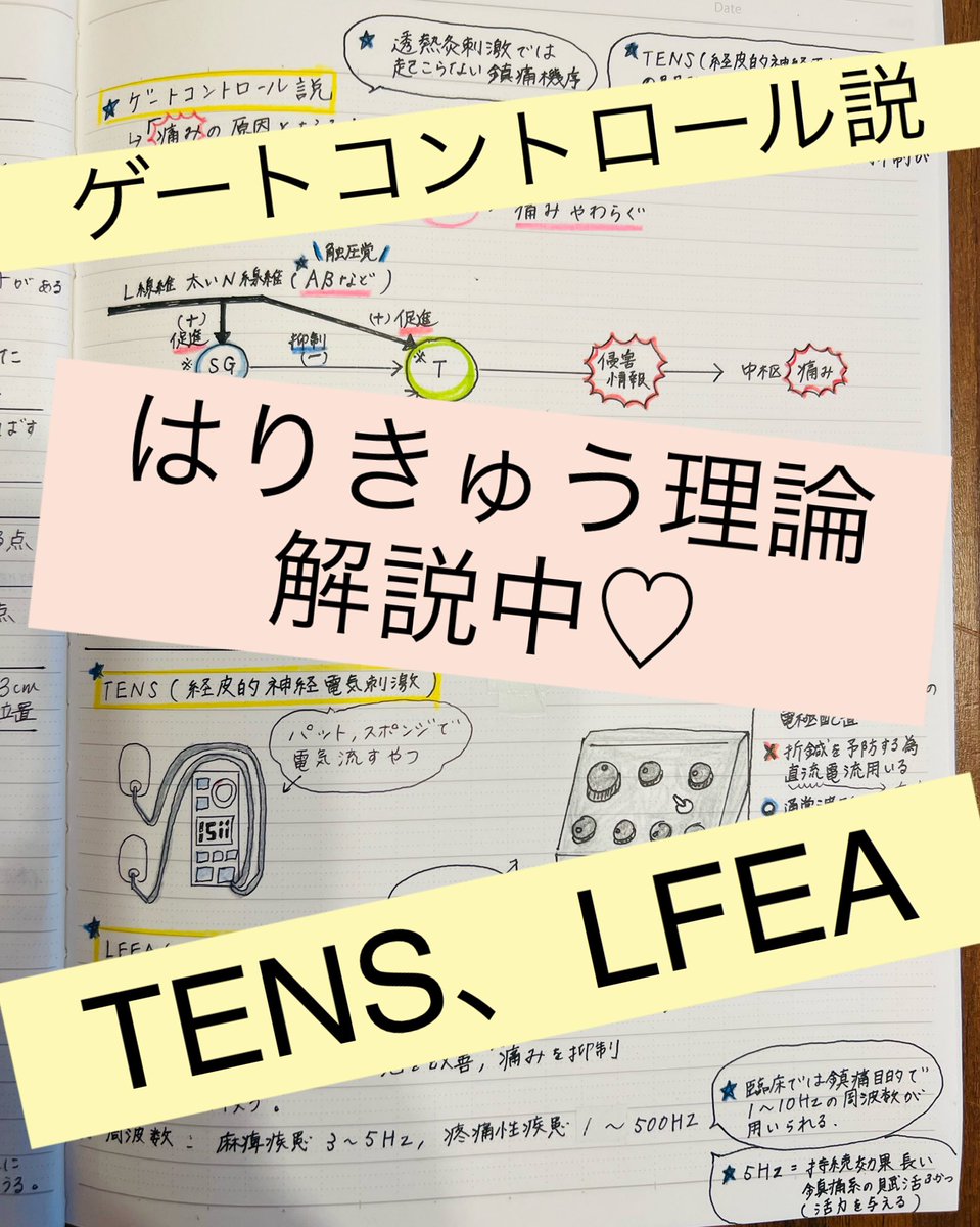 rumischool_oni's tweet photo. こんばんは♡
今日の #はりきゅう理論 #まとめノート は
#ゲートコントロール説
#ゲートコントロール理論
#TENS #経皮的神経電気刺激
#LFEA #低周波鍼置療法
#良導点 #良導絡 #皮電点
#圧発汗反射
です♡♡
LINEオープンチャットで解説中♡
#鍼灸国試 まであと166日😊🌸
#鍼灸学生 #勉強垢 #鍼灸 https://t.co/FPrAPeYKaK