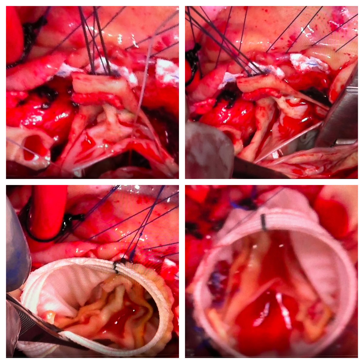 Kim de la Cruz, MD MPH(c) FACS FACC FCCP tweet media