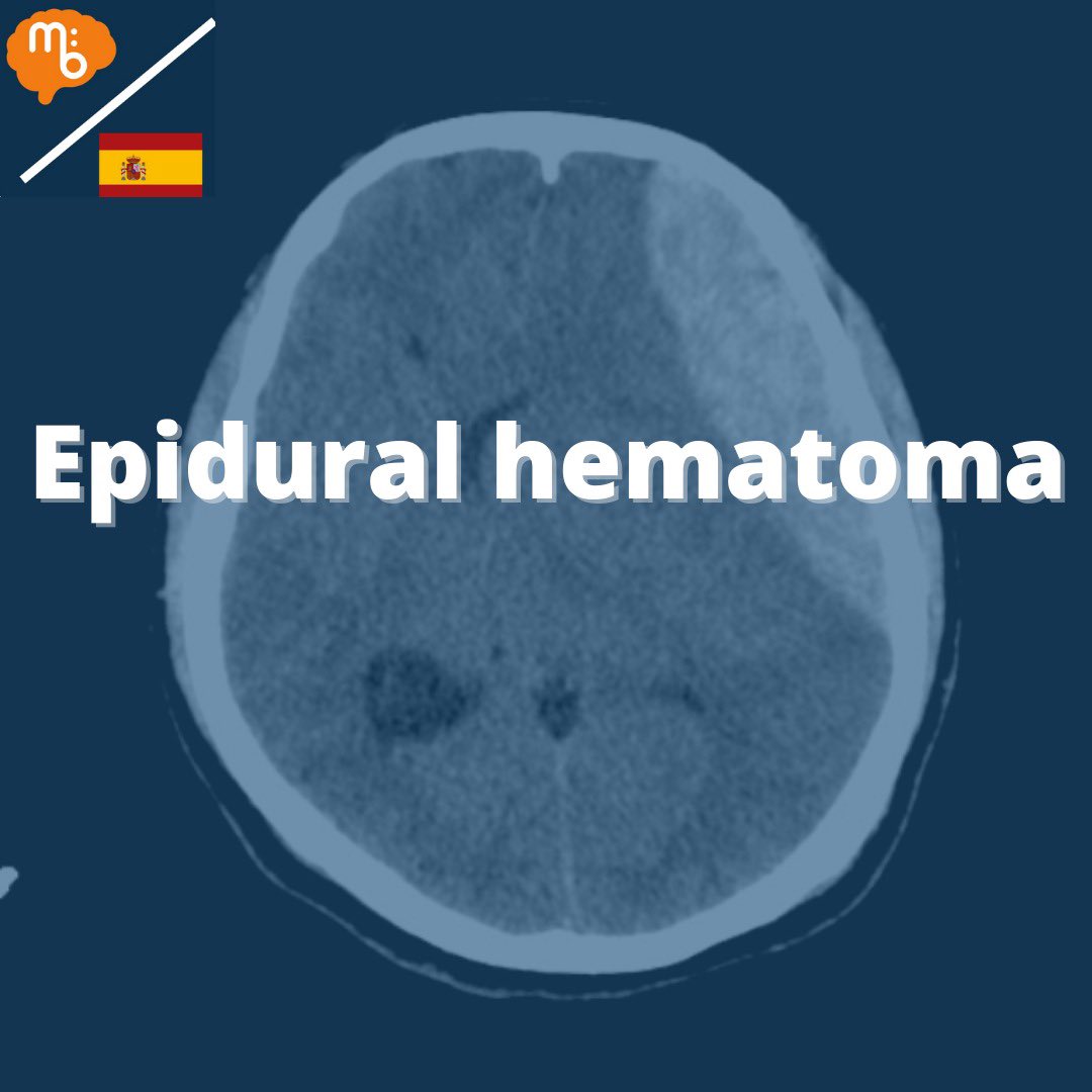 Mission:Brain Complutense tweet media