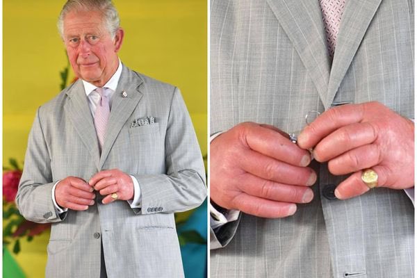 diazolam's tweet photo. No dejo de pensar en cualquier anestesiólog@/enfermer@ que le tenga que canalizar una vía periférica en esas manos al Rey Charles III😰😱😱
(o si hubiera que quitarle el anillo del meñique🤦🏻‍♂️)
#miedito https://t.co/lq2a249wIp