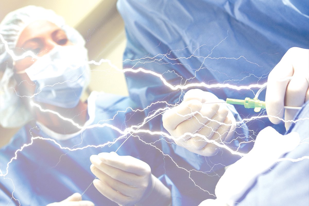 Structural interventional procedures (e.g., TAVR &amp; TEER) are now standards of care with a 📈 list of indications.
 
With #TCT2022 in 4 days, 👇a 🧵 on ⚡️TRANSCATHETER ELECTROSURGERY⚡️; one of the most ingenious &amp; fascinating techniques in the field (&amp; a personal interest of mine)