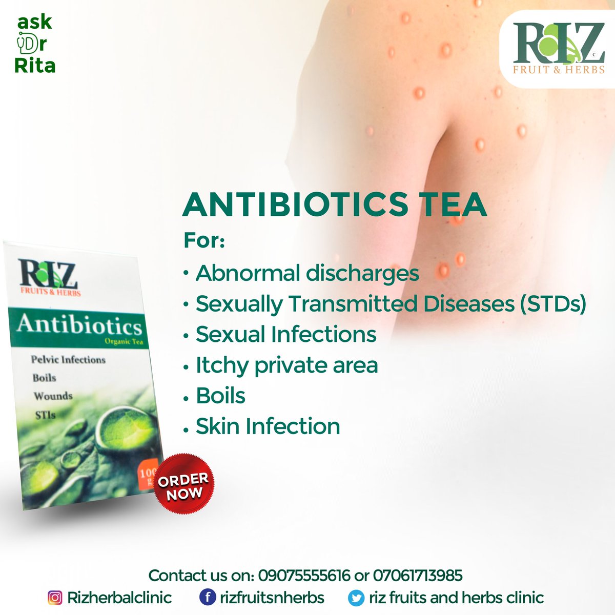 RizFruits's tweet photo. Despite the spreading of diseases around the world today, for example, the recently discovered "Monkeypox". 
You can save yourself from being easily infected by observing healthy habits.
Let's tackle the questions bothering your mind for you, kindly drop questions in the CS. https://t.co/jNAMdbPH9M
