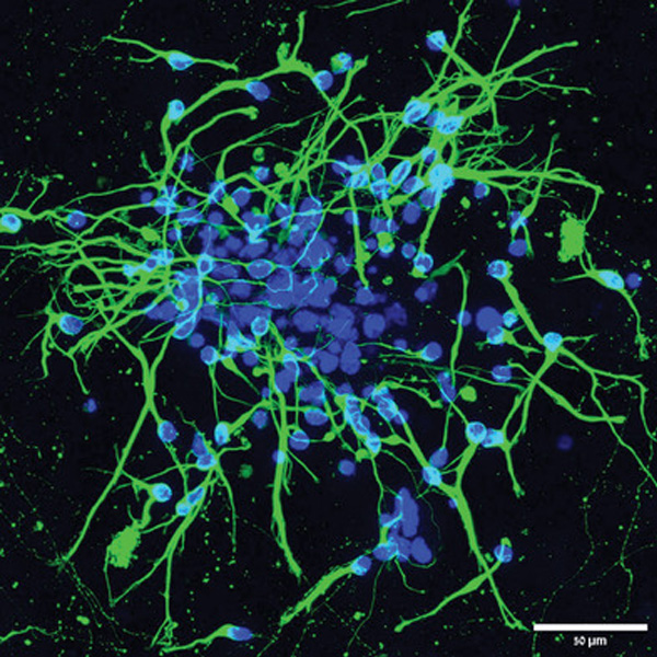 Advanced Portfolio News (@advportfolio) on Twitter photo Nerve cells combined with iron oxide nanoparticles are manipulated using magnetic field gradients
With this method, <a href="/OritShefi/">Orit Shefi</a> and team created functional and beautiful 🤩 3D microarchitectures of neural networks, useful in bioengineering applications
👉 ow.ly/EHzS50KGBBc Nerve cells combined with iron oxide nanoparticles are manipulated using magnetic field gradients
With this method, <a href="/OritShefi/">Orit Shefi</a> and team created functional and beautiful 🤩 3D microarchitectures of neural networks, useful in bioengineering applications
👉 ow.ly/EHzS50KGBBc
