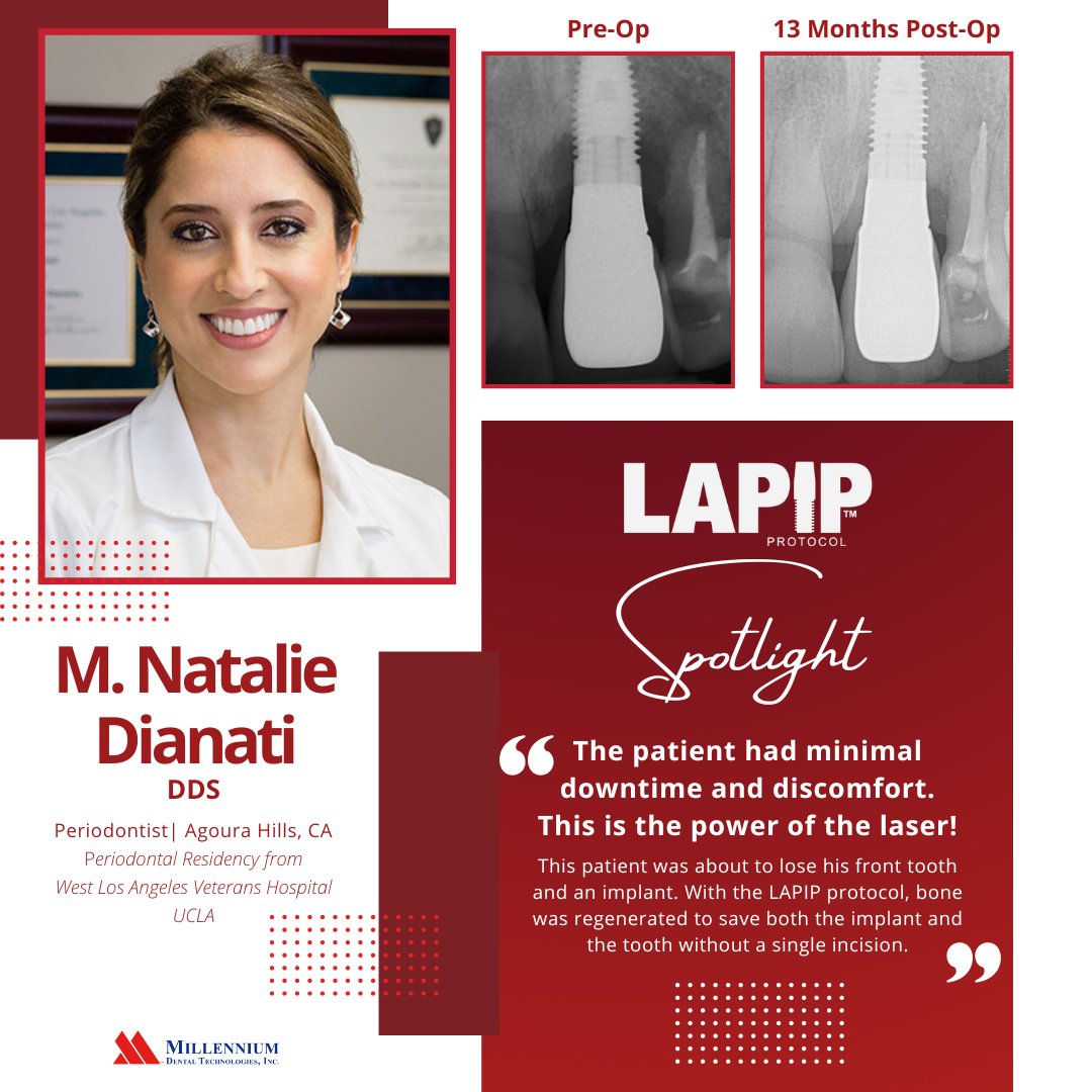 PerioLase4LANAP's tweet photo. It's National Day of Encouragement! And what better way to highlight today with some LANAP and LAPIP protocol spotlights!
#NationalDayofEncouragement #HopeforHopelessTeeth #HopeforHopelessImplants #MotivationMonday #MondayMotivation #Dentistry #LANAP #LAPIP #DentistsofTwitter https://t.co/fBzltIBIfs