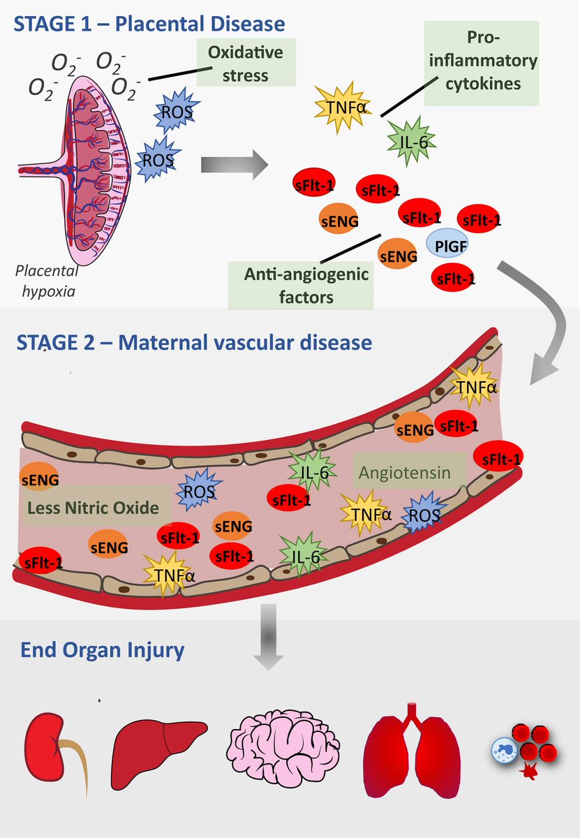AJOG_thegray's tweet photo. AJOG Expert Review in Preeclampsia:  Pravastatin, proton-pump inhibitors, metformin, micronutrients, and biologics: new horizons for the prevention or treatment of preeclampsia https://t.co/bZC757FqKm https://t.co/FFf6nAArCR