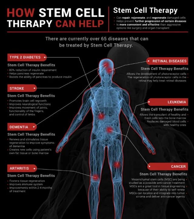 MatchForMarrow's tweet photo. DID YOU KNOW THAT ? 
65 DISEASES CAN BE TREATED BY STEM CELL THERAPY. 

Click here for full article :- 
https://t.co/ftGPKjMXks

#MatchforMarrow #matchformarrowindia #bethematch #blood #stemcells #bloodcancer 

https://t.co/hqr70UHtlm https://t.co/a3WfcwjHrD