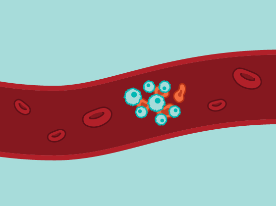 Broad Institute (@broadinstitute) on Twitter photo Not all people respond equally well to CAR-T cell therapy, a kind of immunotherapy that has dramatically improved blood cancer treatment. A new single-cell study by researchers at the Broad, <a href="/MassGeneralNews/">MassGeneral News</a>, and <a href="/DanaFarber/">Dana-Farber</a> could help reveal why. broad.io/carttherapy0912 Not all people respond equally well to CAR-T cell therapy, a kind of immunotherapy that has dramatically improved blood cancer treatment. A new single-cell study by researchers at the Broad, <a href="/MassGeneralNews/">MassGeneral News</a>, and <a href="/DanaFarber/">Dana-Farber</a> could help reveal why. broad.io/carttherapy0912