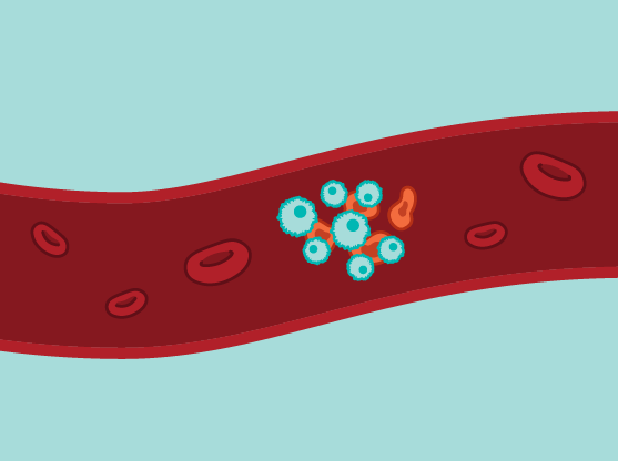 Not all people respond equally well to CAR-T cell therapy, a kind of immunotherapy that has dramatically improved blood cancer treatment. A new single-cell study by researchers at the Broad, @MassGeneralNews, and @DanaFarber could help reveal why. broad.io/carttherapy0912