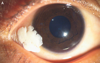 Josh Trebach, MD tweet media