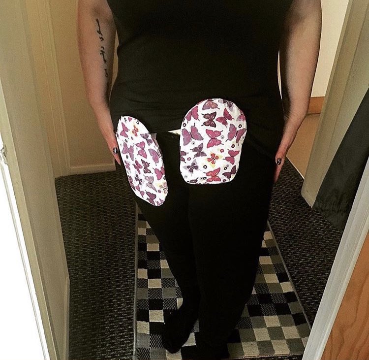 vikkipalmer68's tweet photo. Day12 #urologyawarenessmonth The Urostomy is still very much the forgotten stoma. We trying to raise awareness we need more patient advocate In urology and in the stoma community with urostomys I was  incredibly proud and excited to be part of the campaign. By @rocking2stomas https://t.co/4BXkPQbd0f