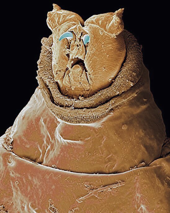 microscopic images. on X: maggot seen through an electron